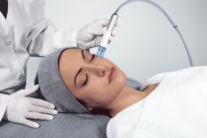 Microdermabrasion